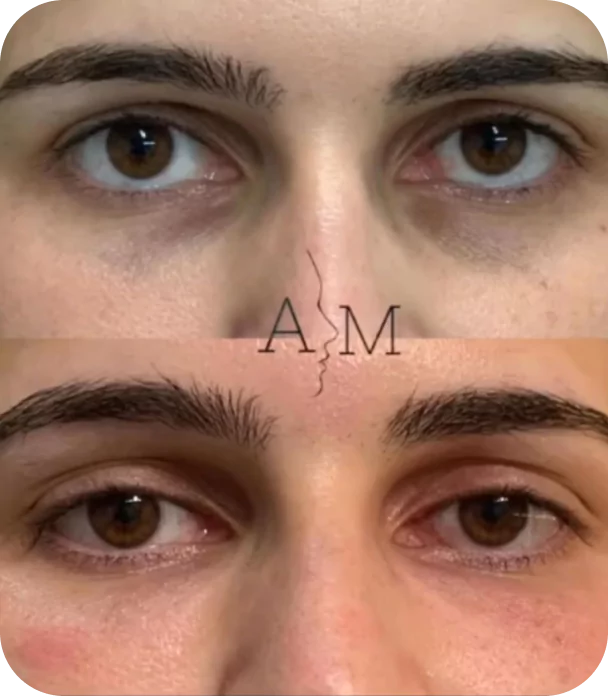 mask-group-1-673f724292263