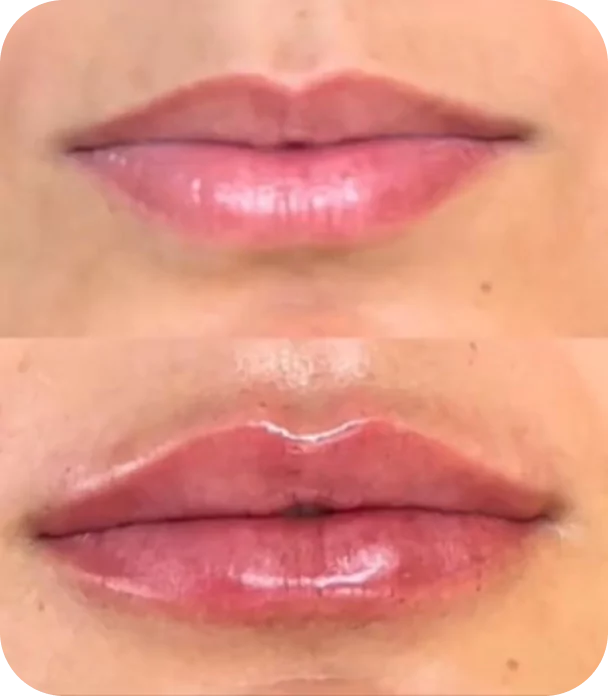 mask-group-673f72413978f