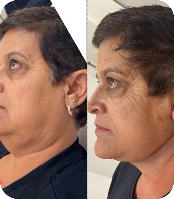 rectangle-22899-673f723cb0d9b