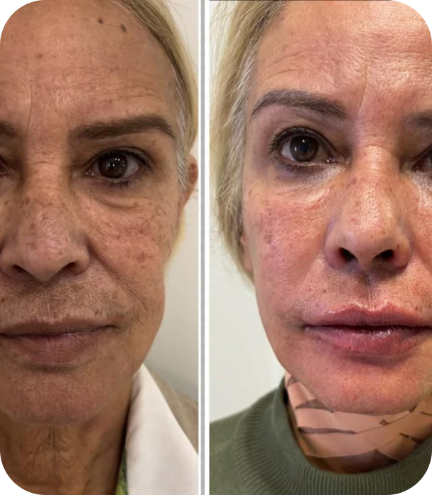 rectangle-22904-673f723ca9f2b