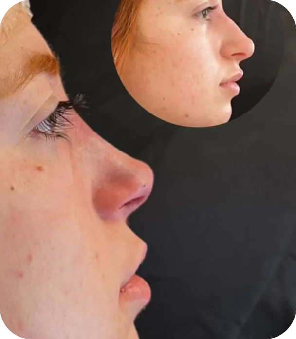 rectangle-22905-673f723e981f7