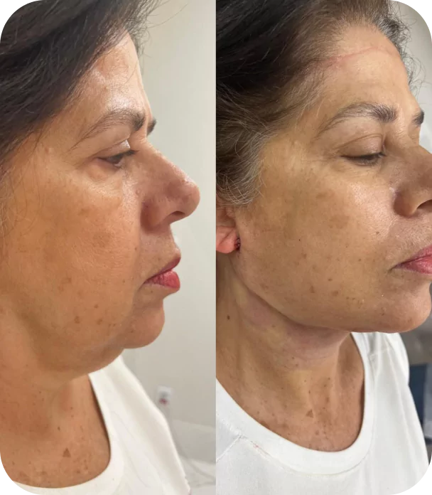 rectangle-22909-673f72403dae0